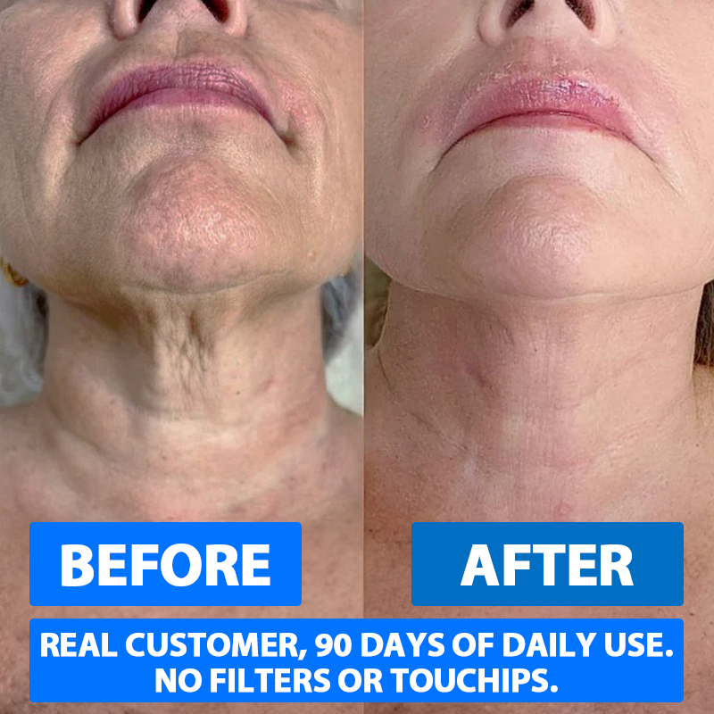 NMN (Nicotinamide Mononucleotide) Pure Powder